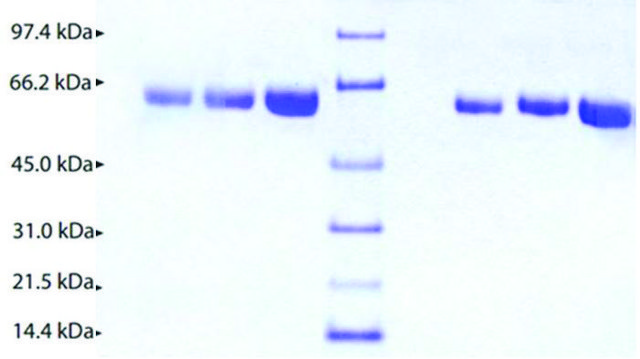 Alpha 2 Antiplasmin from human