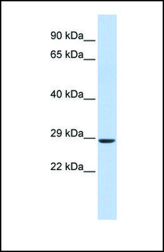 Anti-SIX2, (N-terminal) antibody produced in