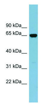 Anti-IL22RA1 antibody produced in rabbit