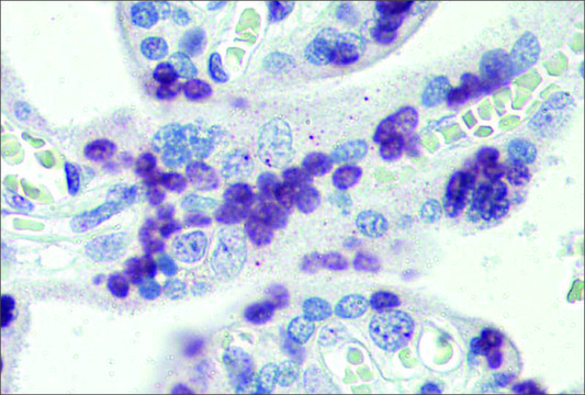 Anti-PRDM9 antibody produced in rabbit
