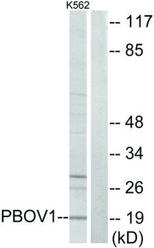 Anti-PBOV1 antibody produced in rabbit