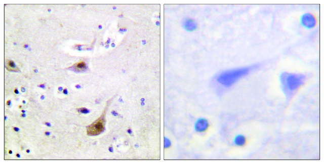 Anti-Androgen Receptor, N-Terminal antibody produced