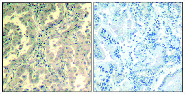Anti-STAT2 (Ab-690) antibody produced in