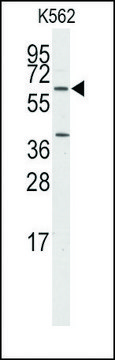 Anti-WIF1 (N-term) antibody produced in
