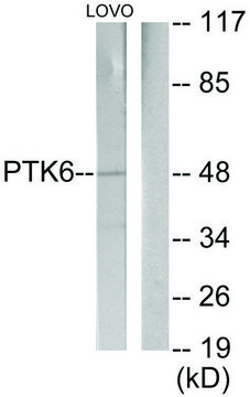 Anti-Breast Tumor Kinase antibody produced