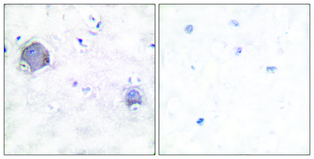 Anti-NOTCH1 (Cleaved-Val¹???) antibody produced in