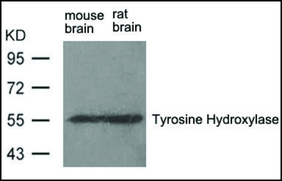 Anti-Th (Ab-31) antibody produced in