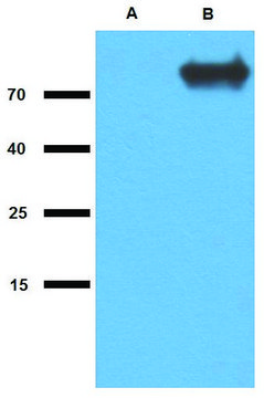 Anti-GlcB (M. tuberculosis) antibody produced