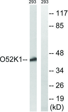 Anti-OR52K1 antibody produced in rabbit