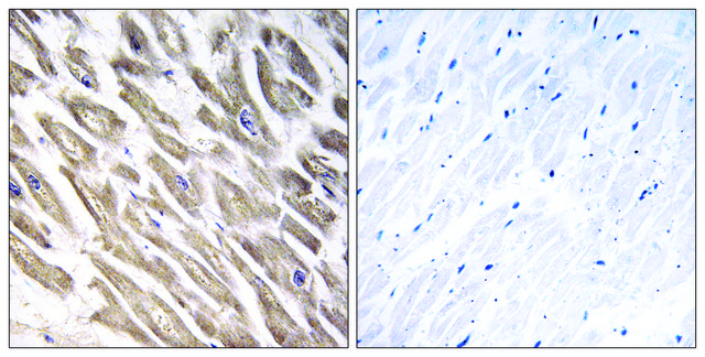 Anti-F13B antibody produced in rabbit