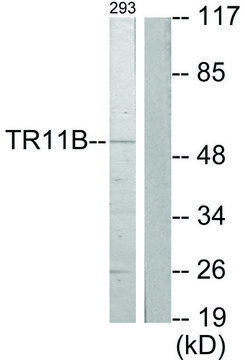 Anti-TR11B antibody produced in rabbit