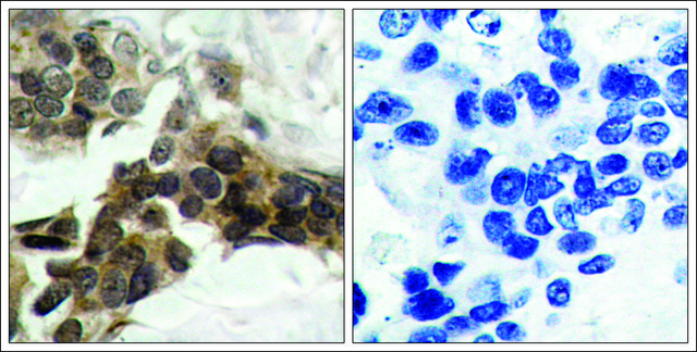 Anti-phospho-NFKBIA (pSer³²/pSer³?) antibody produced in