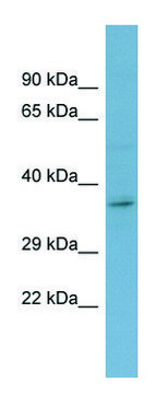 Anti-GHR (C-terminal) antibody produced in