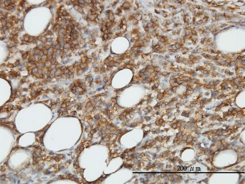 Monoclonal Anti-CAMK2B antibody produced in