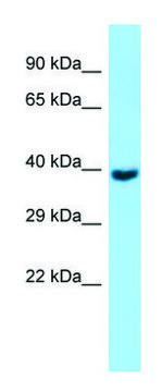 Anti-GNA11 (C-terminal) antibody produced in