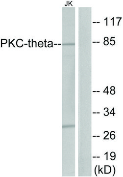 Anti-PKC THET antibody produced in