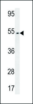 ANTI-FAM46A (CENTER) antibody produced in