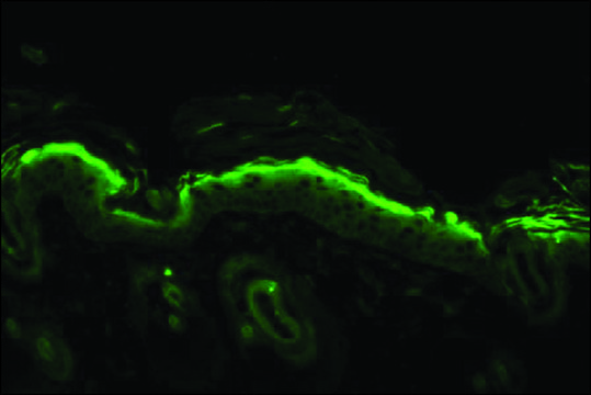 Monoclonal Anti-Nitrotyrosine antibody produced in