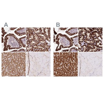 Anti-PCK2 antibody produced in rabbit