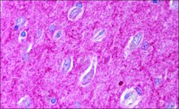 Anti-ICAM5 Precursor antibody produced in