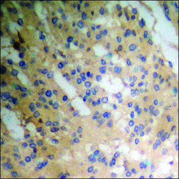 Anti-phospho-Smad1 (pSer???) antibody produced in