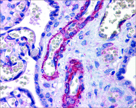 Anti-SUZ12 antibody produced in rabbit