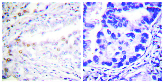 Anti-UBA2 antibody produced in rabbit