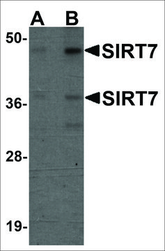 Anti-SIRT7 antibody produced in chicken