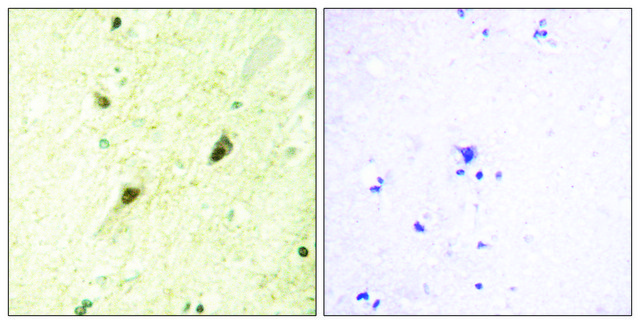 Anti-GLI-3 antibody produced in rabbit