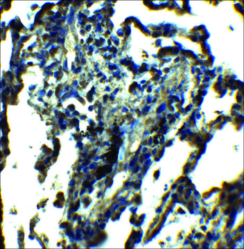 Anti-NDFIP1 antibody produced in rabbit