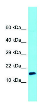 Anti-UQCC2 (C-terminal) antibody produced in