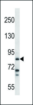 ANTI-HDC (N-TERM) antibody produced in