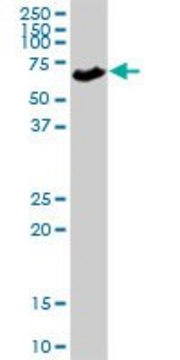 Anti-SLC5A1 antibody produced in rabbit