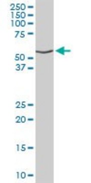 Anti-DNAJC7 antibody produced in rabbit