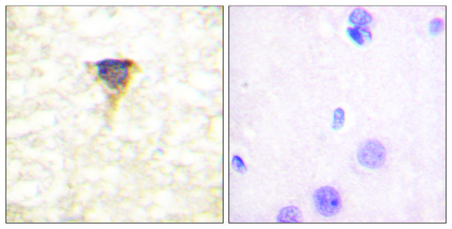 Anti-CAMK4 antibody produced in rabbit