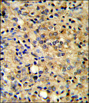 ANTI-COMP (CENTER) antibody produced in