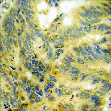 Anti-phospho-STAT6 (pTyr??¹) antibody produced in