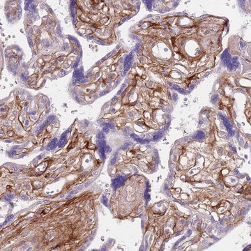 Anti-TINAGL1 antibody produced in rabbit