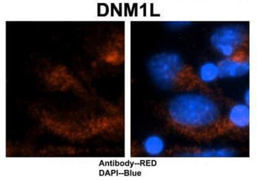 Anti-DNM1L, (N-terminal) antibody produced in