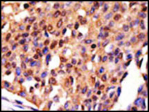 Anti-ABCB6 (C-term) antibody produced in