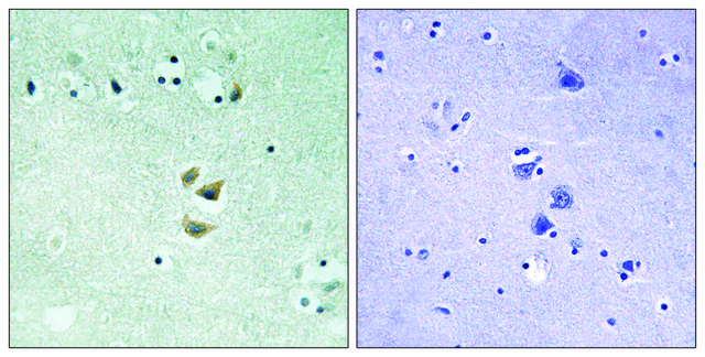Anti-PRKCA antibody produced in rabbit