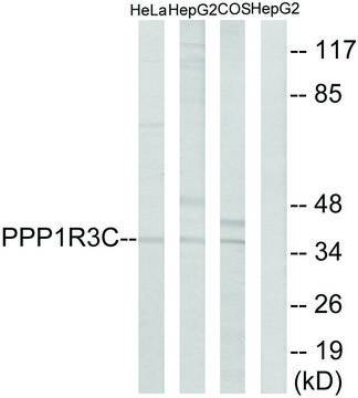 Anti-PPP1R3C antibody produced in rabbit