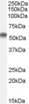 Anti-NAC1/BTBD14B antibody produced in goat