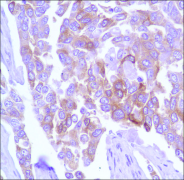 Anti-TAU antibody, Rabbit monoclonal