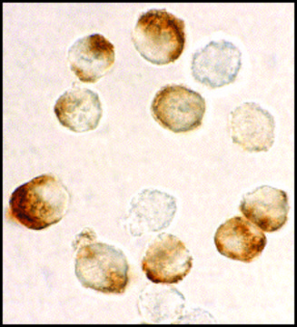 Anti-IKK beta antibody produced in
