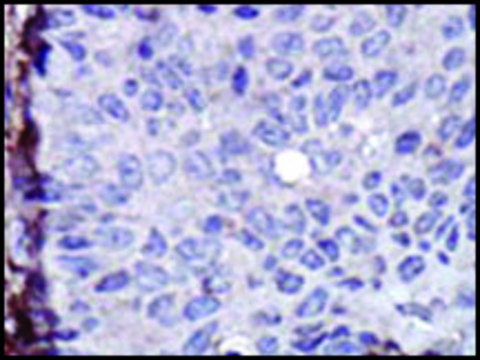 Anti-DGKI (N-term) antibody produced in