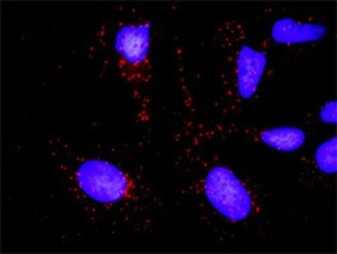 Anti-KLK3 antibody produced in rabbit