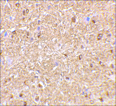 Anti-NOGOA (ab1) antibody produced in