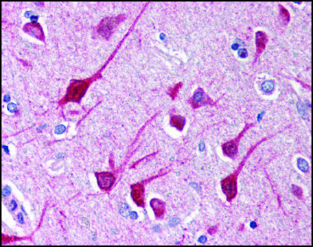 Anti-NLRP1 antibody produced in rabbit