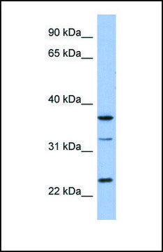 Anti-SOX21 antibody produced in rabbit